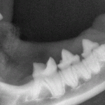 normal-tooth-with-healthy-bone-150x150